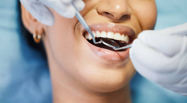 Best Emergency Wisdom Tooth Extraction in Galena, IL