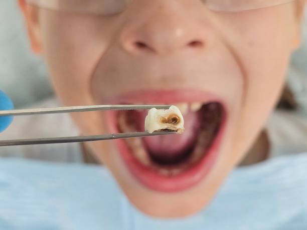 Best Emergency Treatment for Oral Infections in Galena, IL